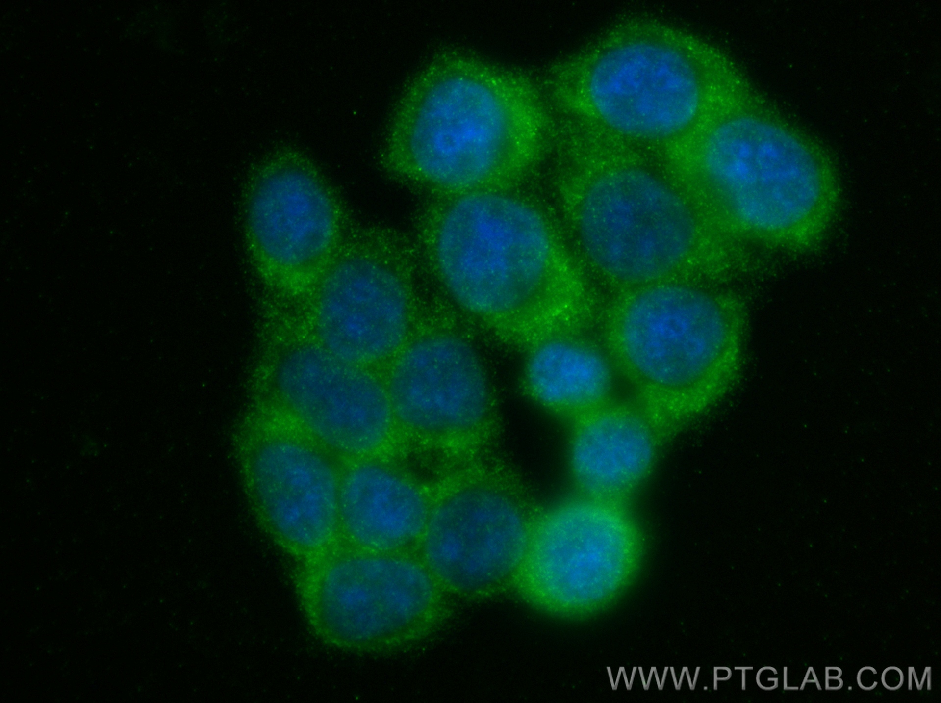 IF Staining of BxPC-3 using 14231-1-AP