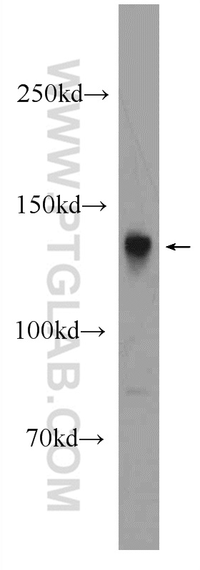 WB analysis of rat brain using 24512-1-AP