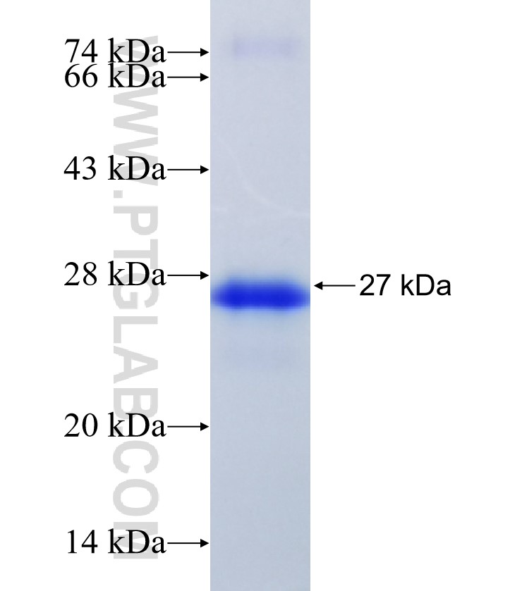 STXBP5L fusion protein Ag34104 SDS-PAGE STXBP5L fusion protein Ag34104 SDS-PAGE