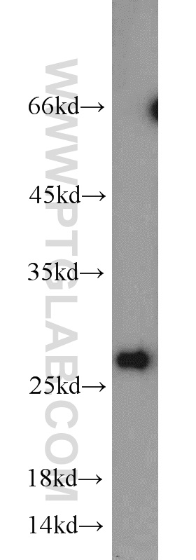 WB analysis of mouse brain using 10976-4-AP