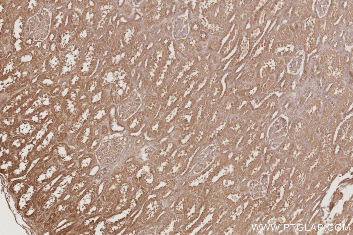 IHC staining of human kidney using 16433-1-AP IHC staining of human kidney using 16433-1-AP