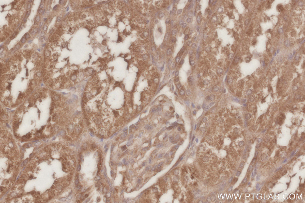 IHC staining of human kidney using 16433-1-AP IHC staining of human kidney using 16433-1-AP
