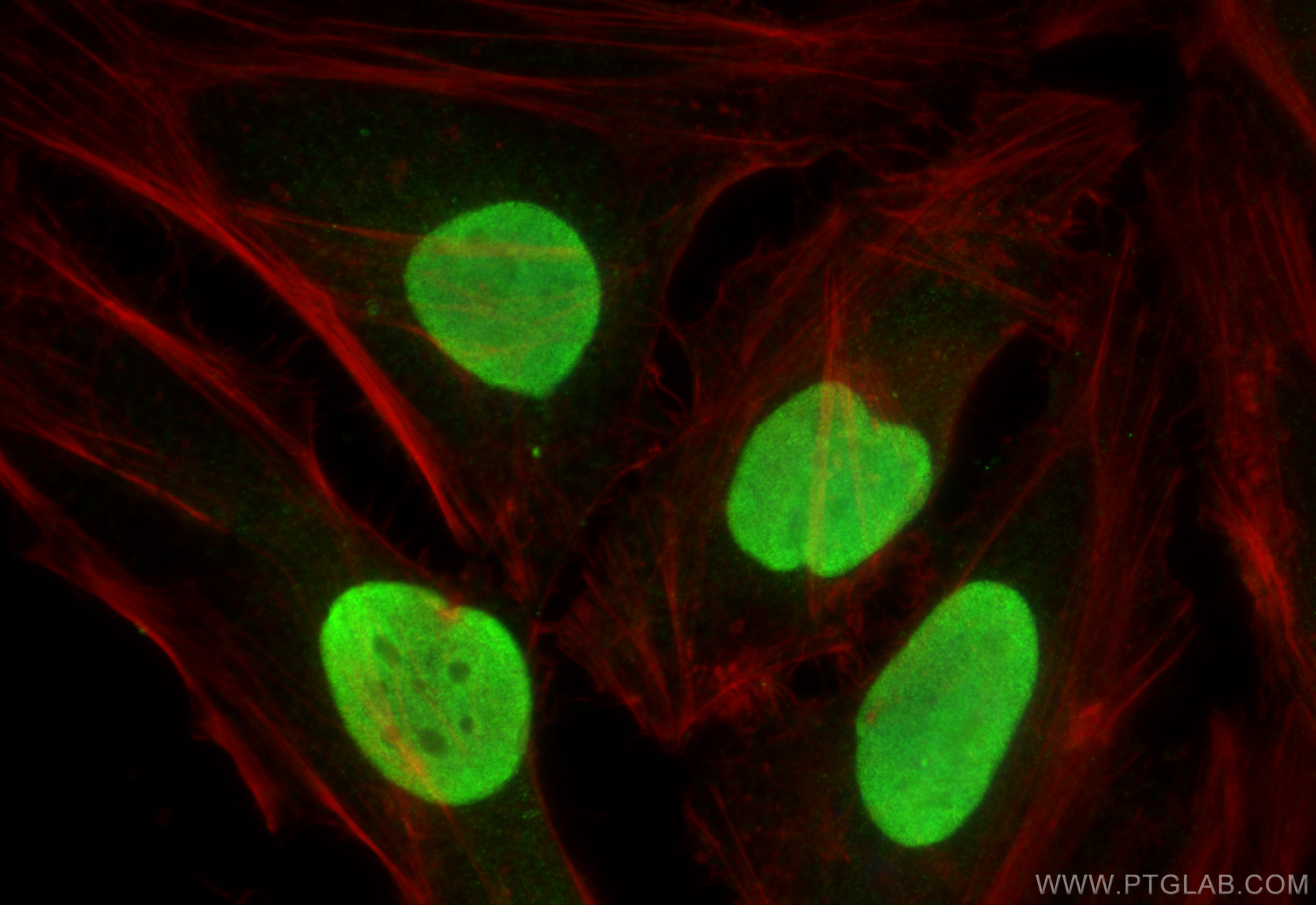 IF Staining of HeLa using 11956-1-AP