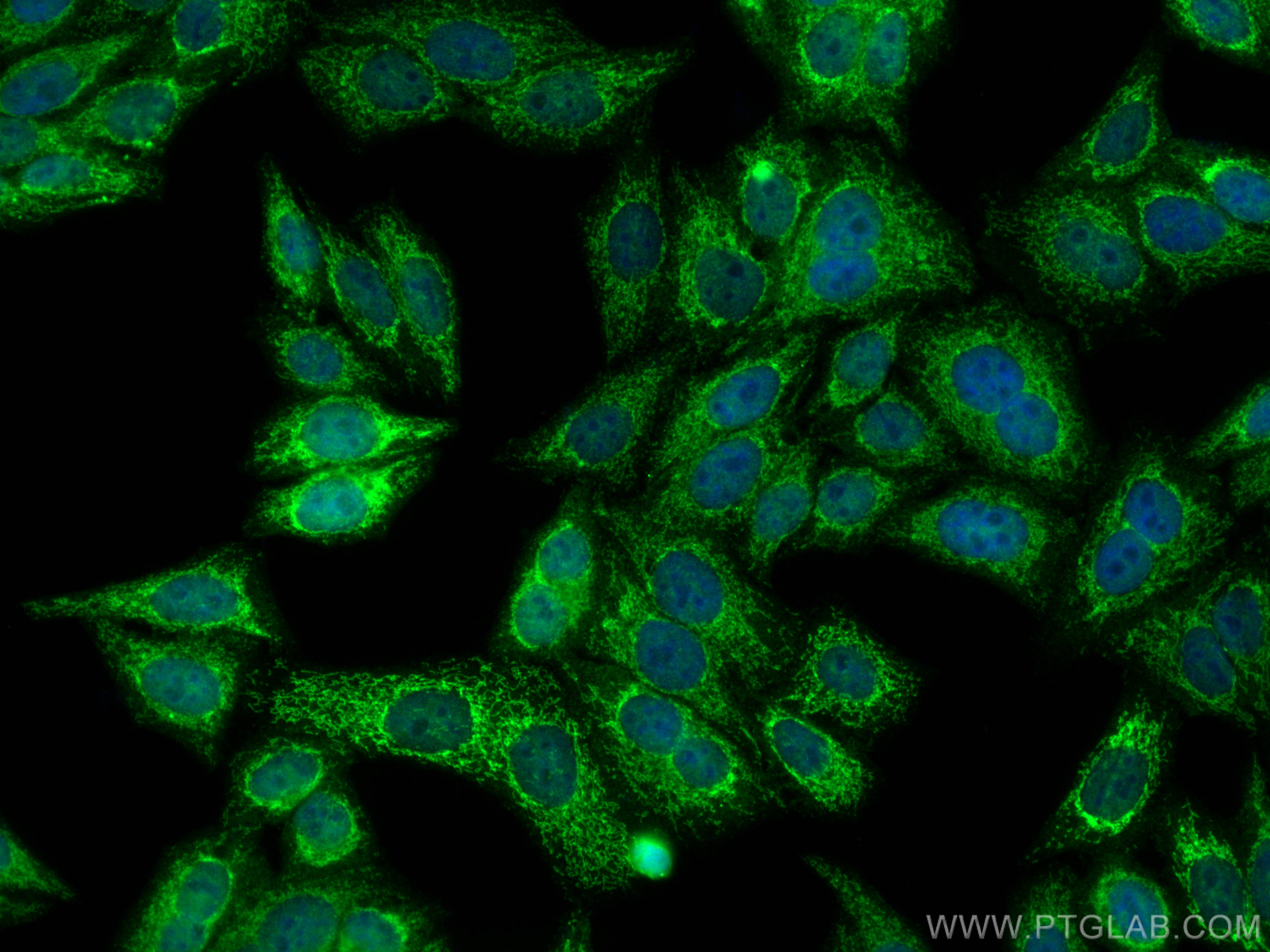 IF Staining of HepG2 using 12627-1-AP