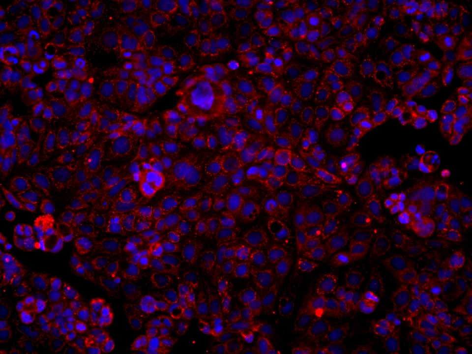 IF Staining of Caco-2 using 68549-1-Ig (same clone as 68549-1-PBS)