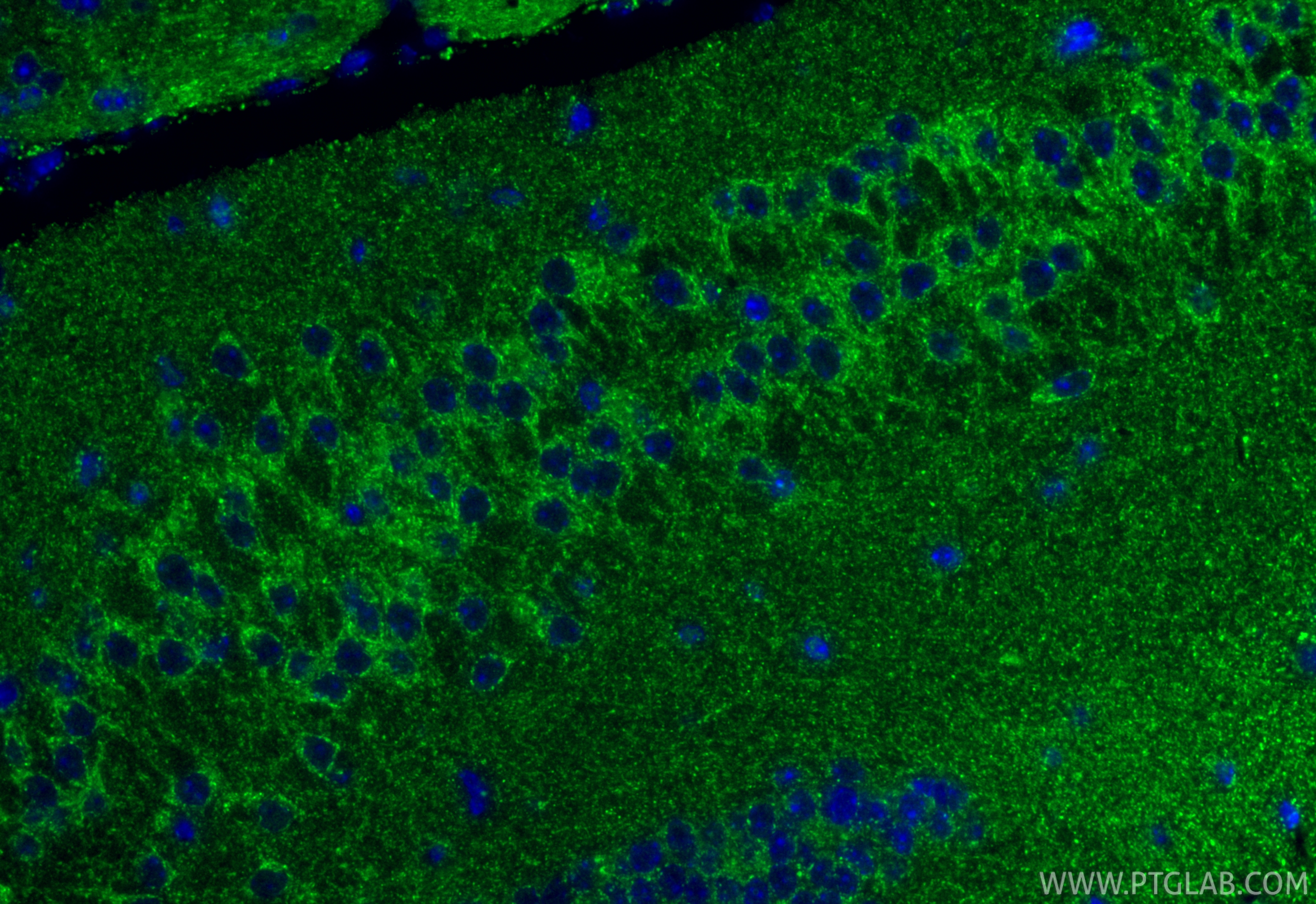 IF Staining of mouse brain using 14923-1-AP IF Staining of mouse brain using 14923-1-AP