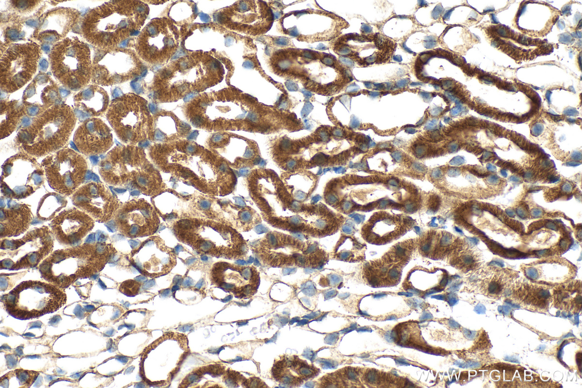 IHC staining of mouse kidney using 14923-1-AP