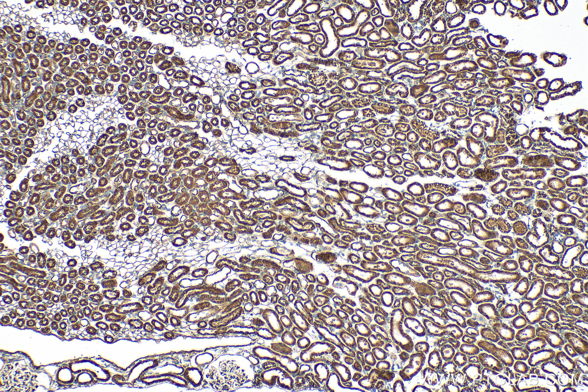 IHC staining of mouse kidney using 14923-1-AP