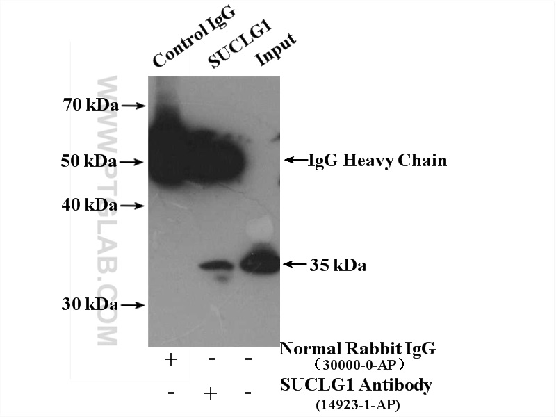 IP experiment of mouse kidney using 14923-1-AP