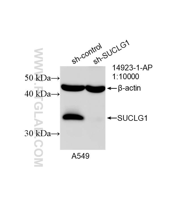 WB analysis of A549 using 14923-1-AP