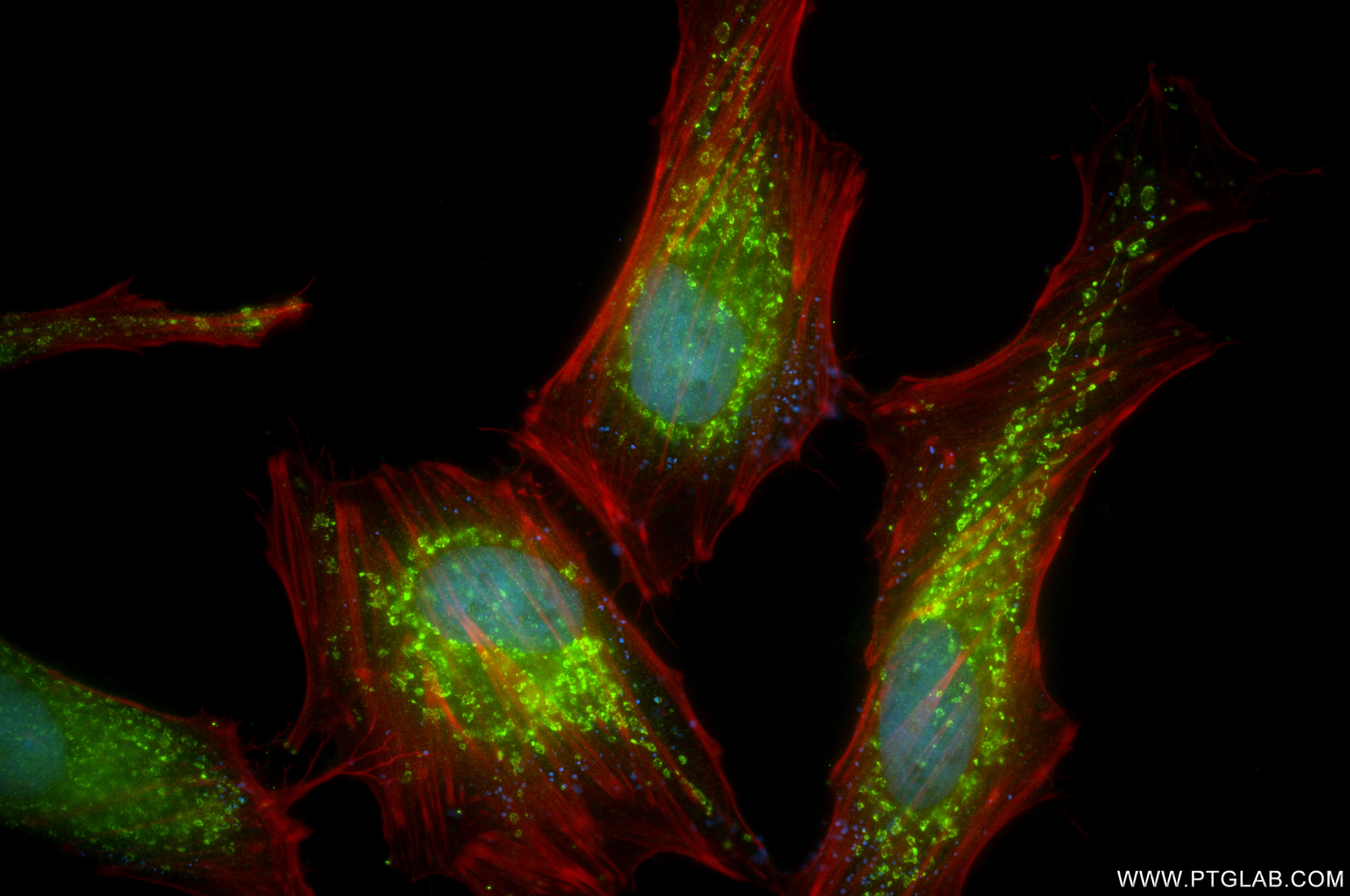 IF Staining of HeLa using 86072-1-RR (same clone as 86072-1-PBS)