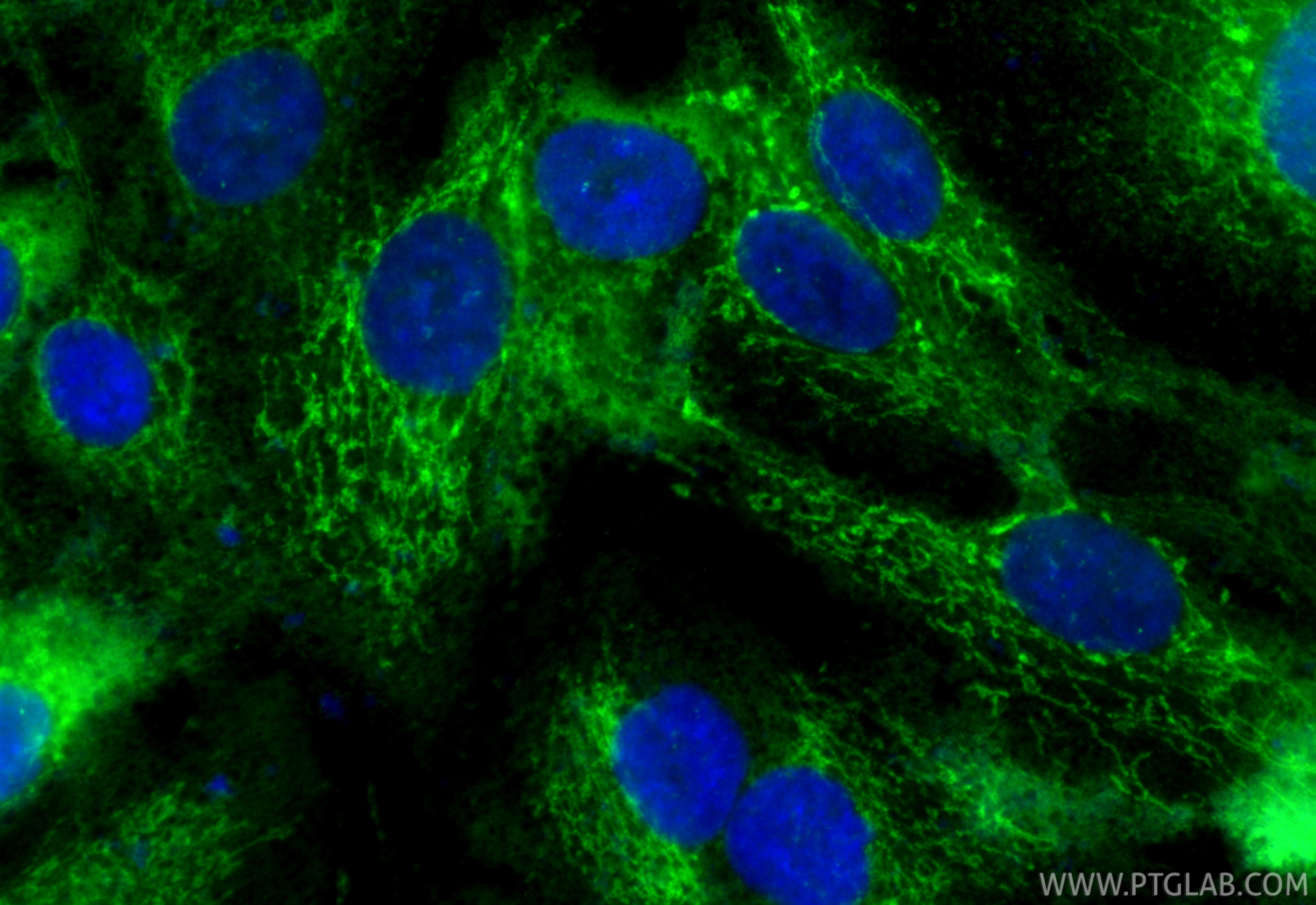 IF Staining of A549 using CL488-86072