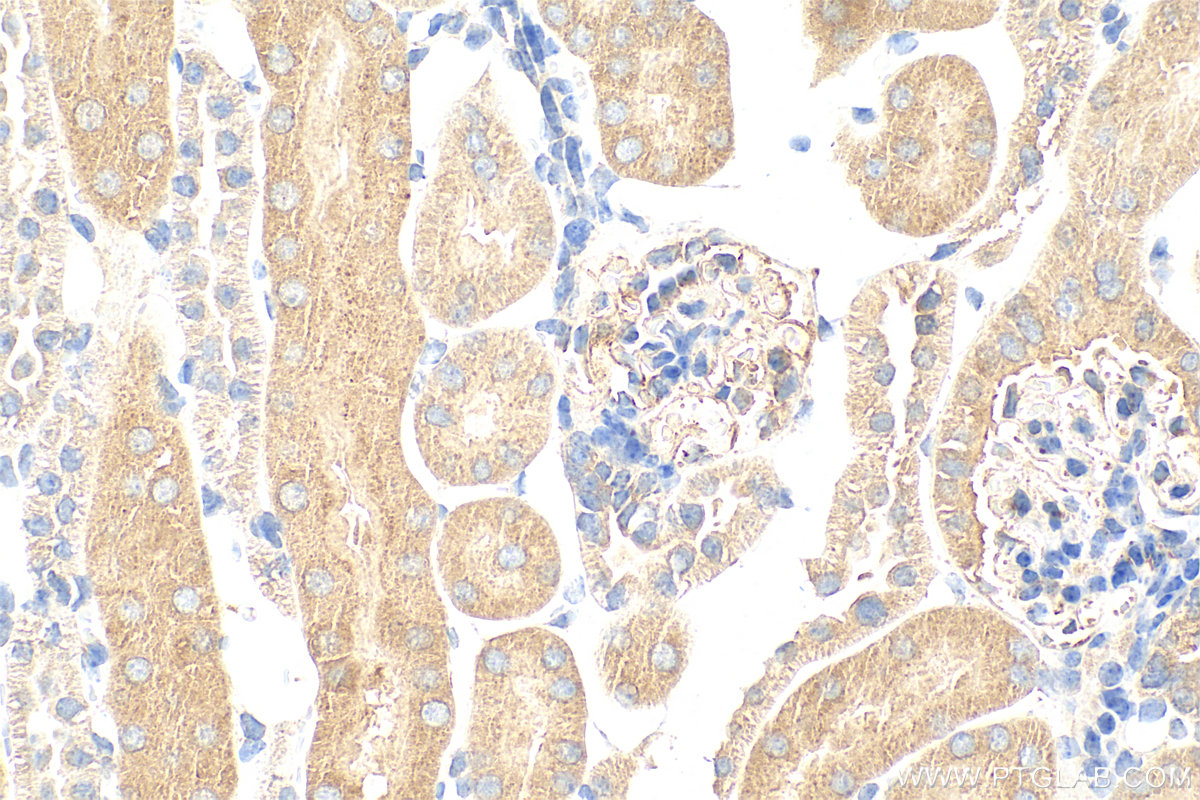 IHC staining of mouse kidney using 31987-1-AP