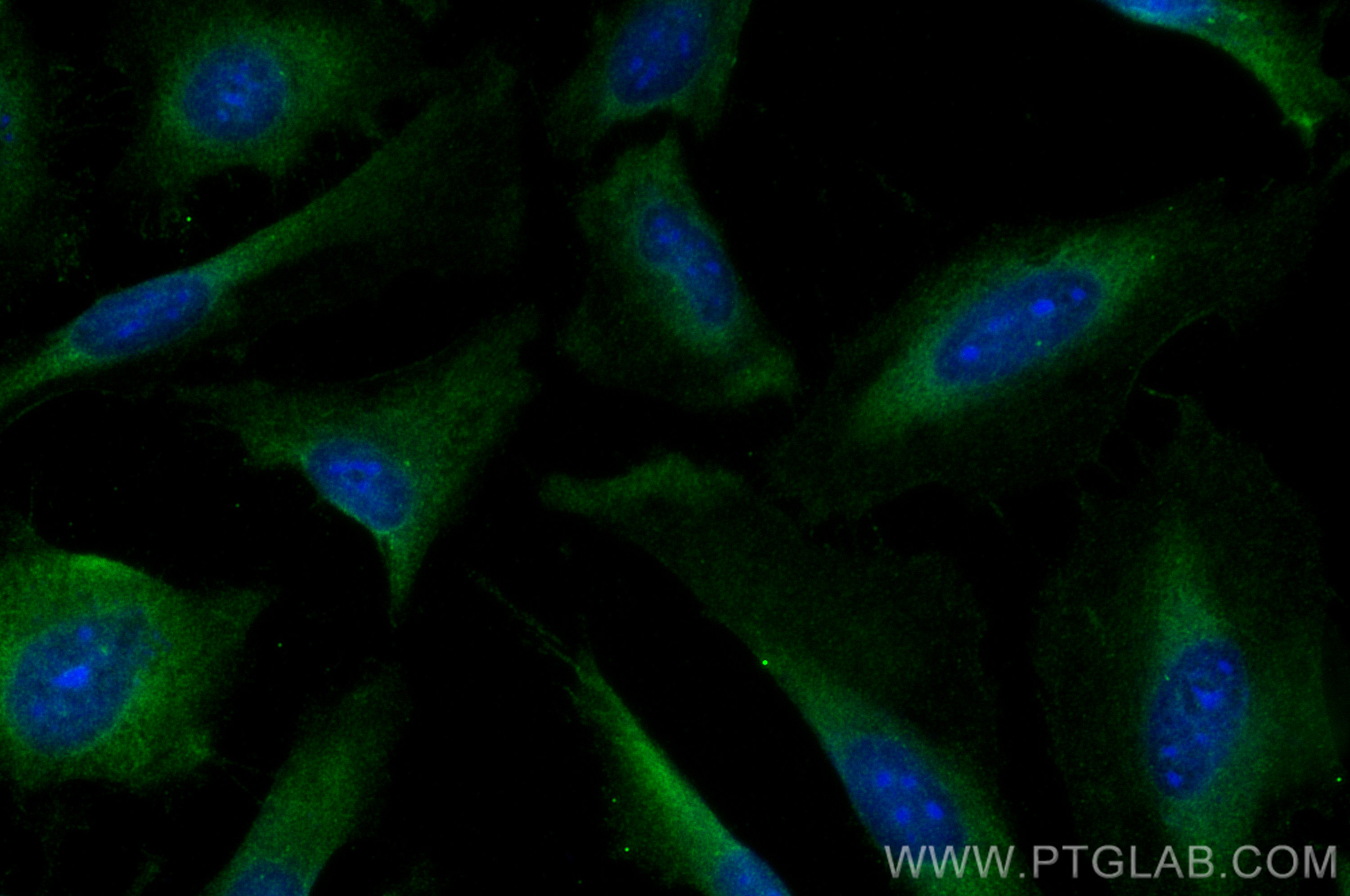 IF Staining of HeLa using 26759-1-AP