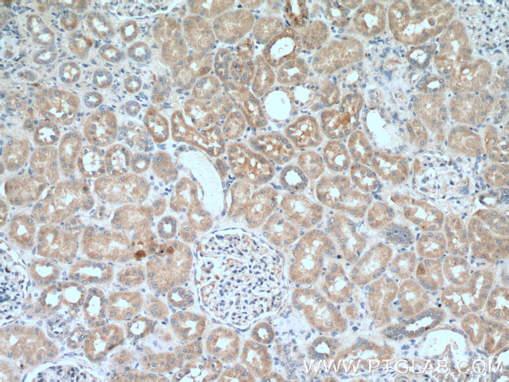 IHC staining of human kidney using 26759-1-AP