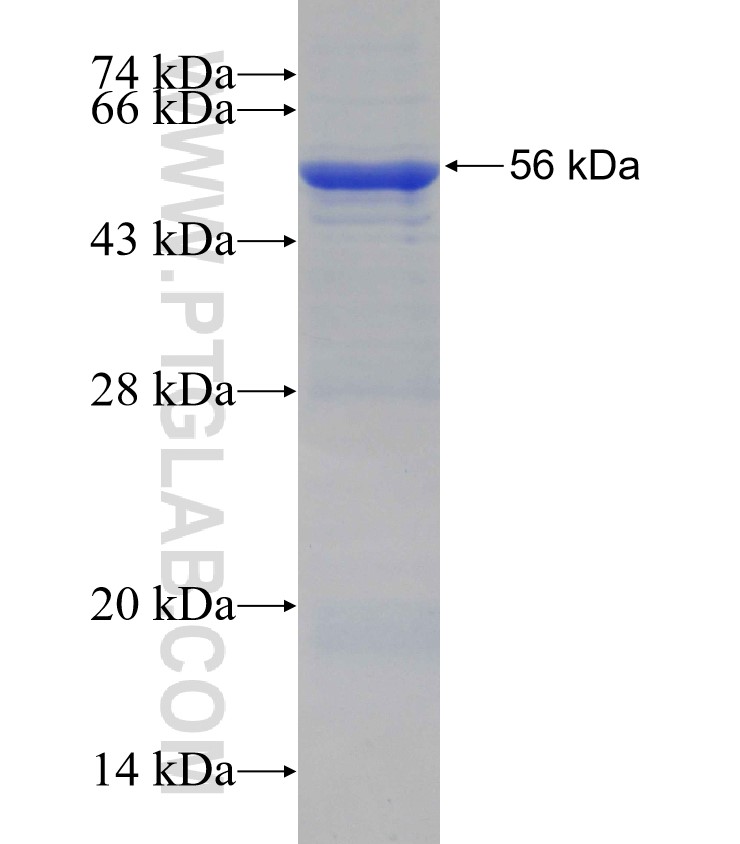 SUFU fusion protein Ag25193 SDS-PAGE