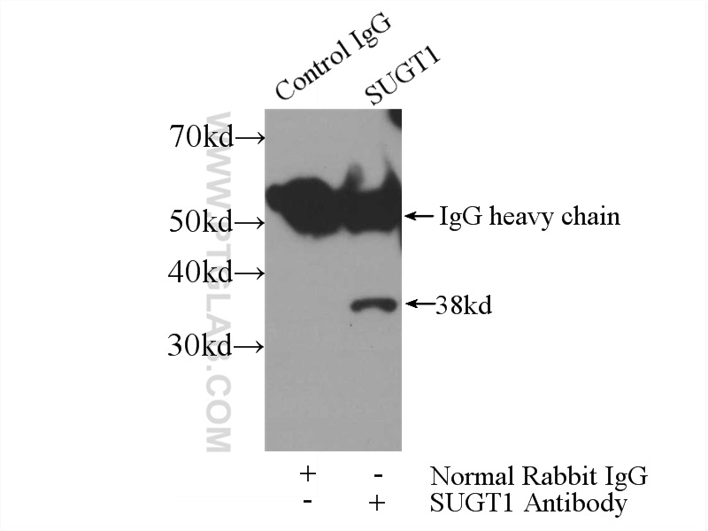 IP experiment of HEK-293 using 11675-1-AP