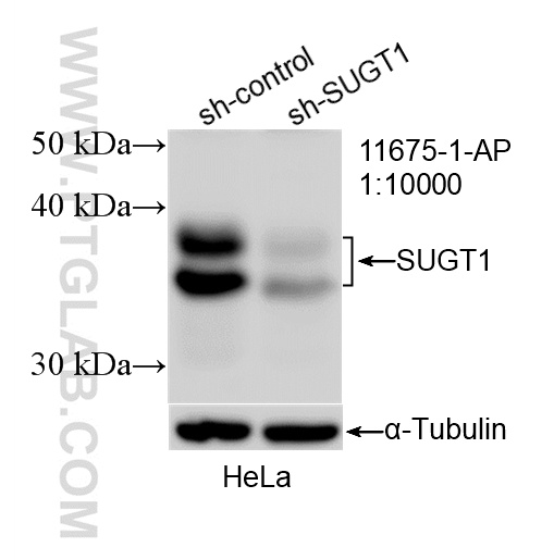 WB analysis of HeLa using 11675-1-AP