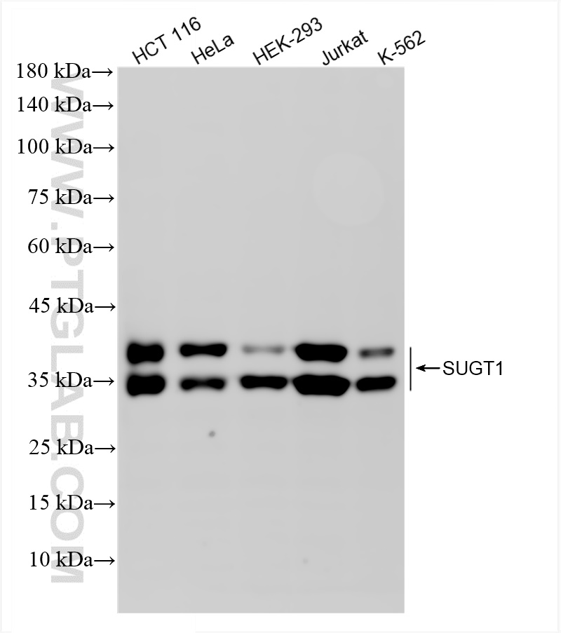 WB analysis using 84963-5-RR