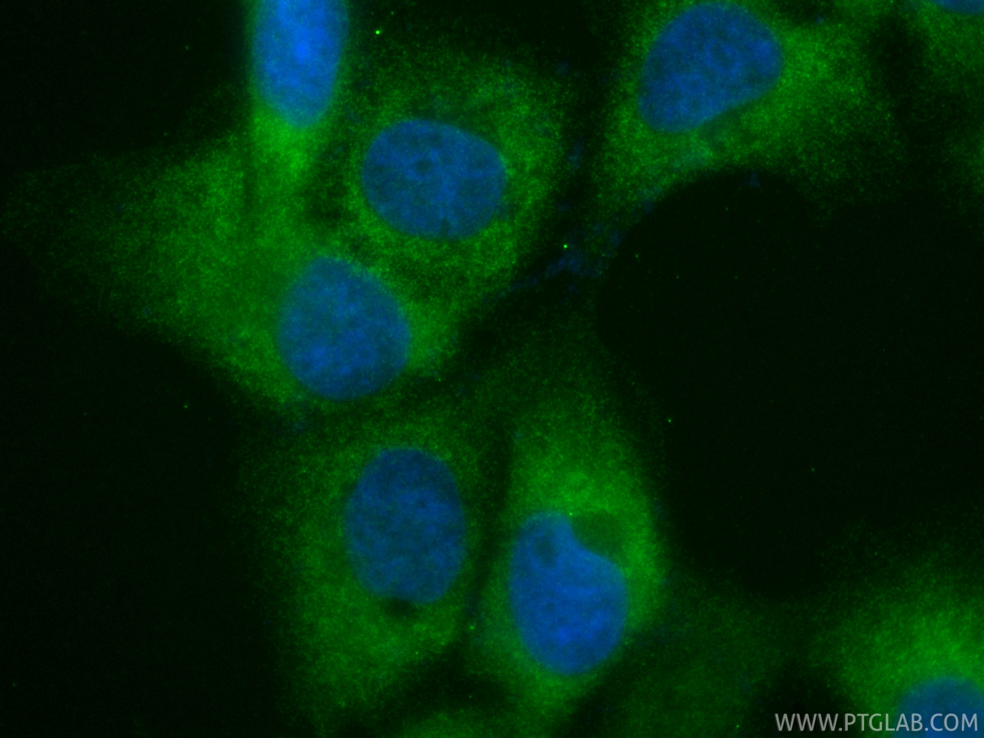 IF Staining of A431 using CL488-84963-5 IF Staining of A431 using CL488-84963-5