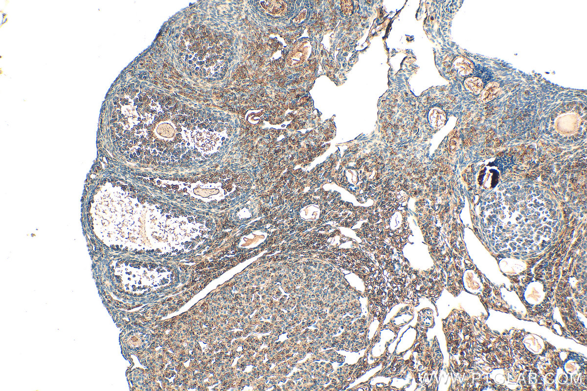 Immunohistochemical analysis of paraffin-embedded mouse ovary tissue slide using 12260-1-AP (SULF2 antibody) at dilution of 1:200 (under 10x lens). Heat mediated antigen retrieval with Tris-EDTA buffer (pH 9.0). IHC staining of mouse ovary using 12260-1-AP