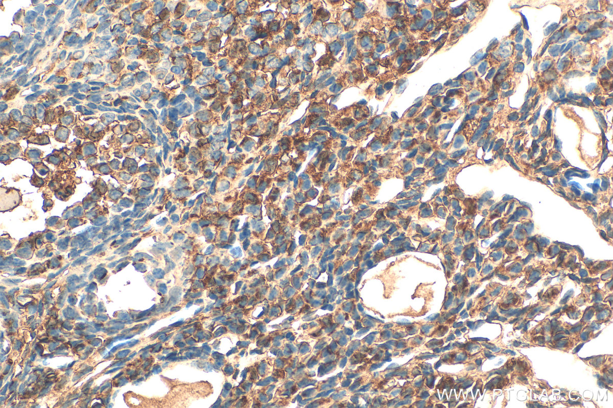 Immunohistochemical analysis of paraffin-embedded mouse ovary tissue slide using 12260-1-AP (SULF2 antibody) at dilution of 1:200 (under 40x lens). Heat mediated antigen retrieval with Tris-EDTA buffer (pH 9.0). IHC staining of mouse ovary using 12260-1-AP