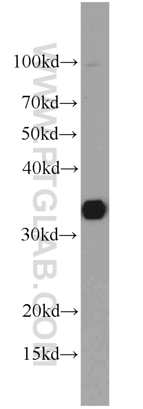 WB analysis of mouse liver using 10911-2-AP