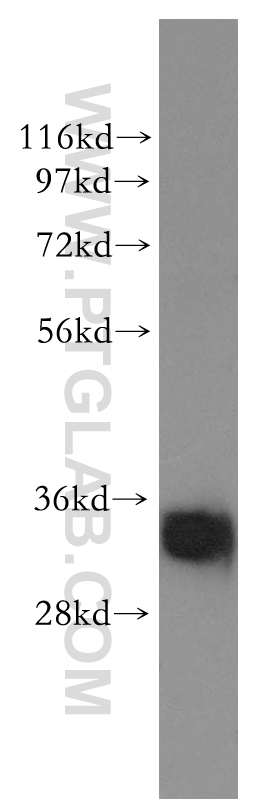 WB analysis of human colon using 11376-1-AP