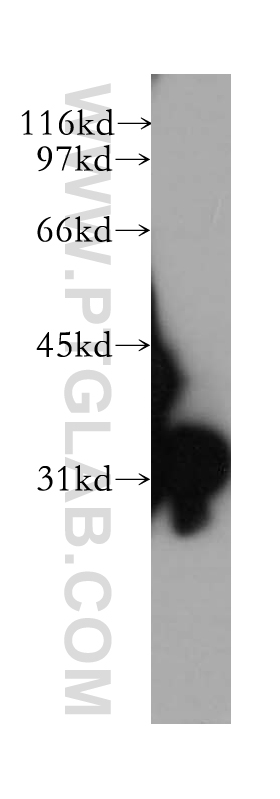 WB analysis of human lung using 12522-1-AP