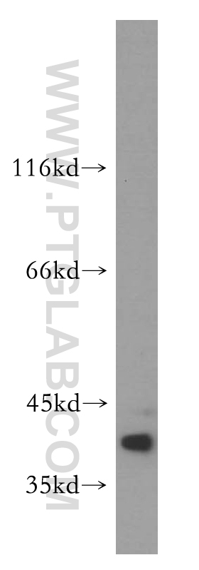 WB analysis of mouse skin using 12879-1-AP