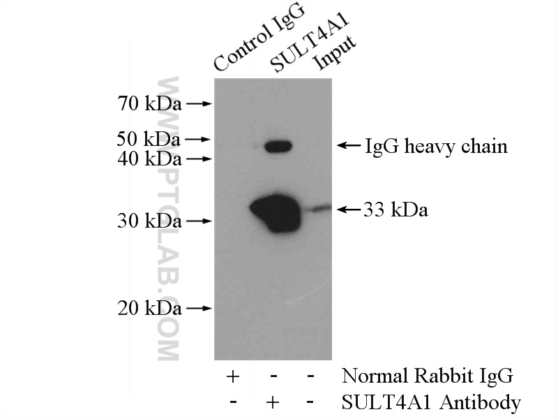 IP experiment of mouse brain using 12578-1-AP