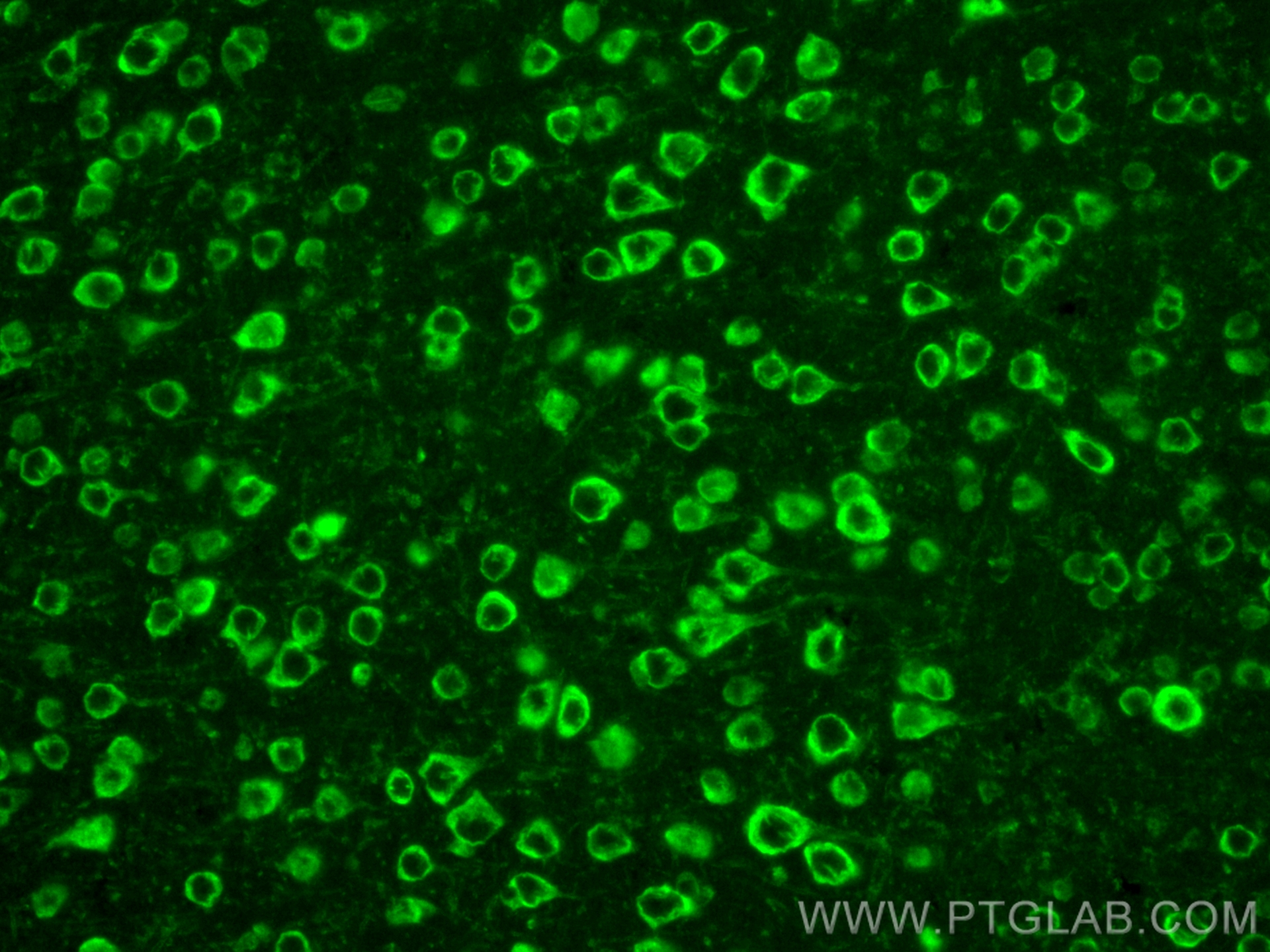 IF Staining of mouse brain using CL488-66106