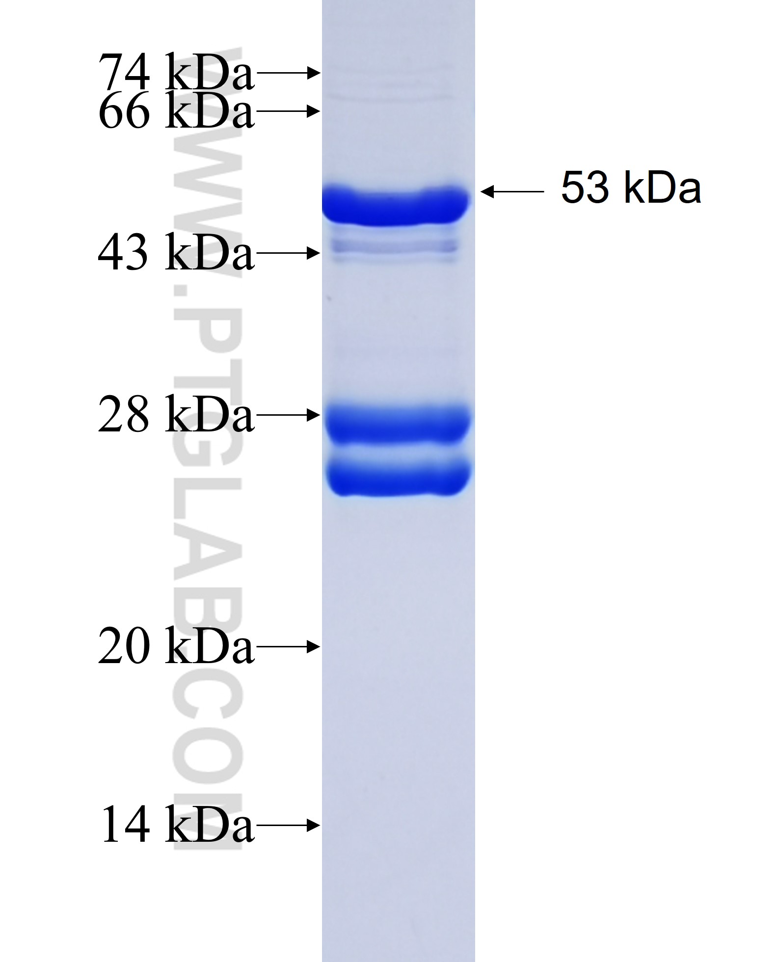 SULT6B1 fusion protein Ag23385 SDS-PAGE SULT6B1 fusion protein Ag23385 SDS-PAGE