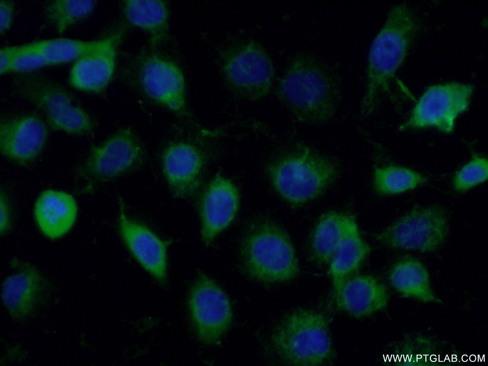 IF Staining of A431 using 11210-1-AP