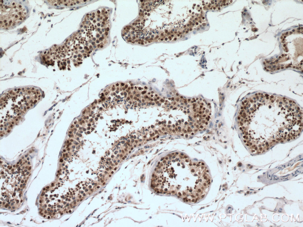 IHC staining of human testis using 10329-1-AP