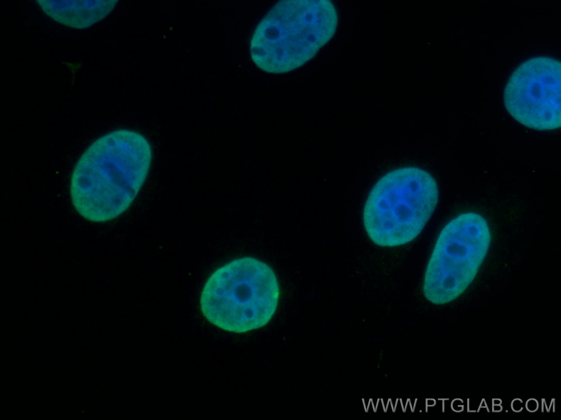 IF Staining of MCF-7 using 67559-1-Ig