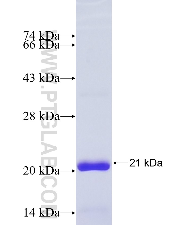 SUMO1 fusion protein Ag29402 SDS-PAGE