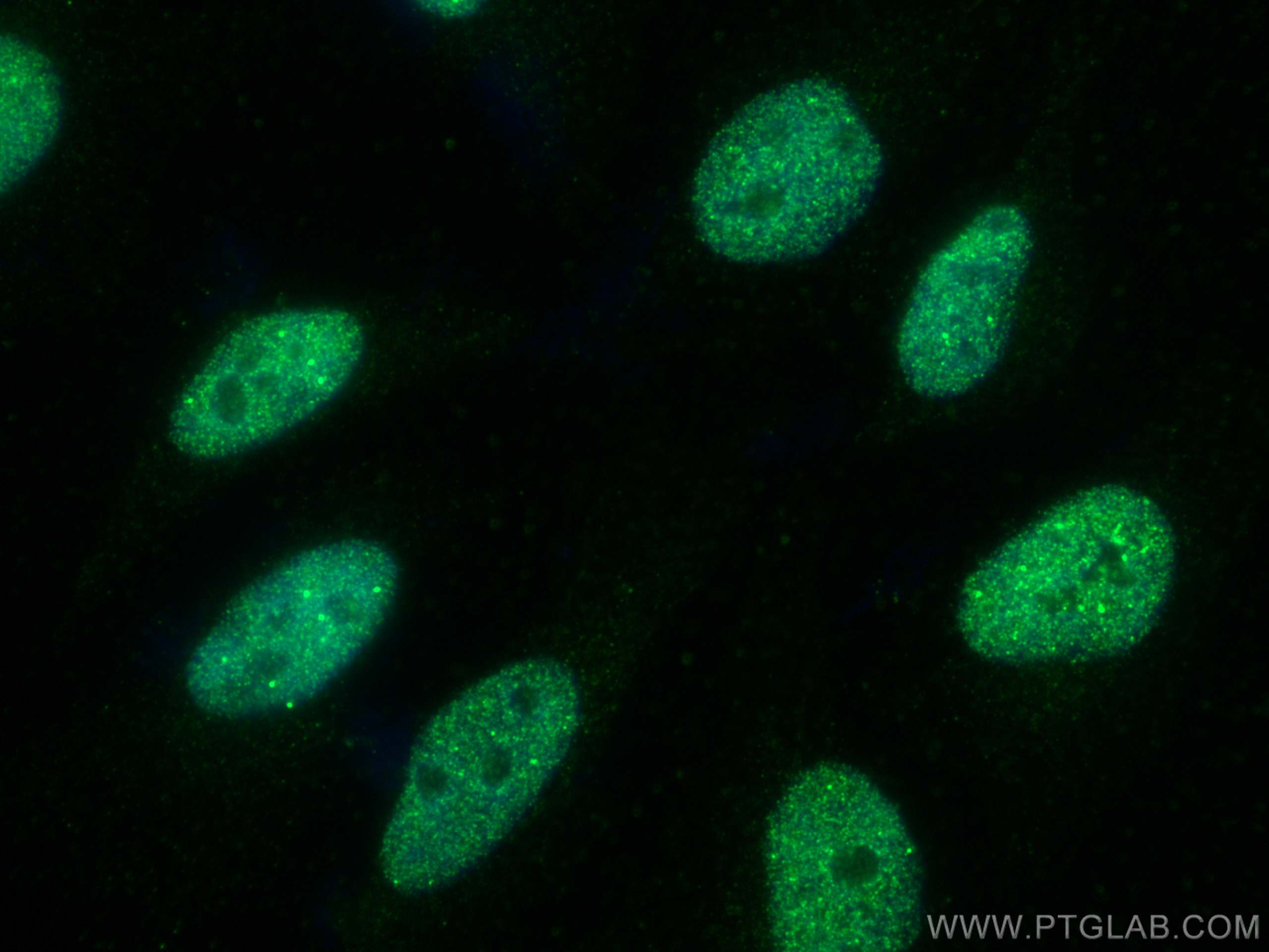 IF Staining of HeLa using 67154-1-Ig (same clone as 67154-1-PBS)