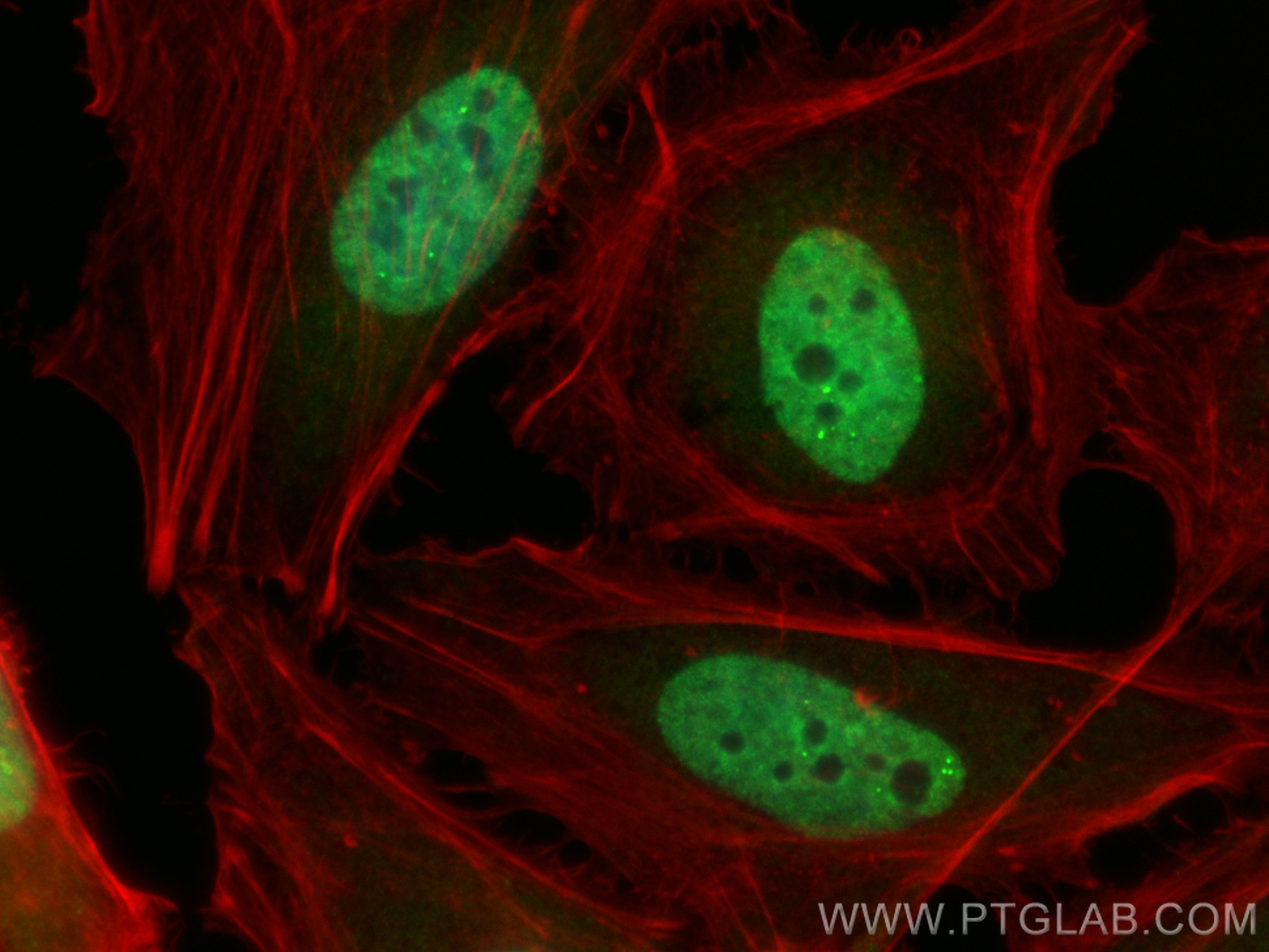 IF Staining of HeLa using CL488-67154
