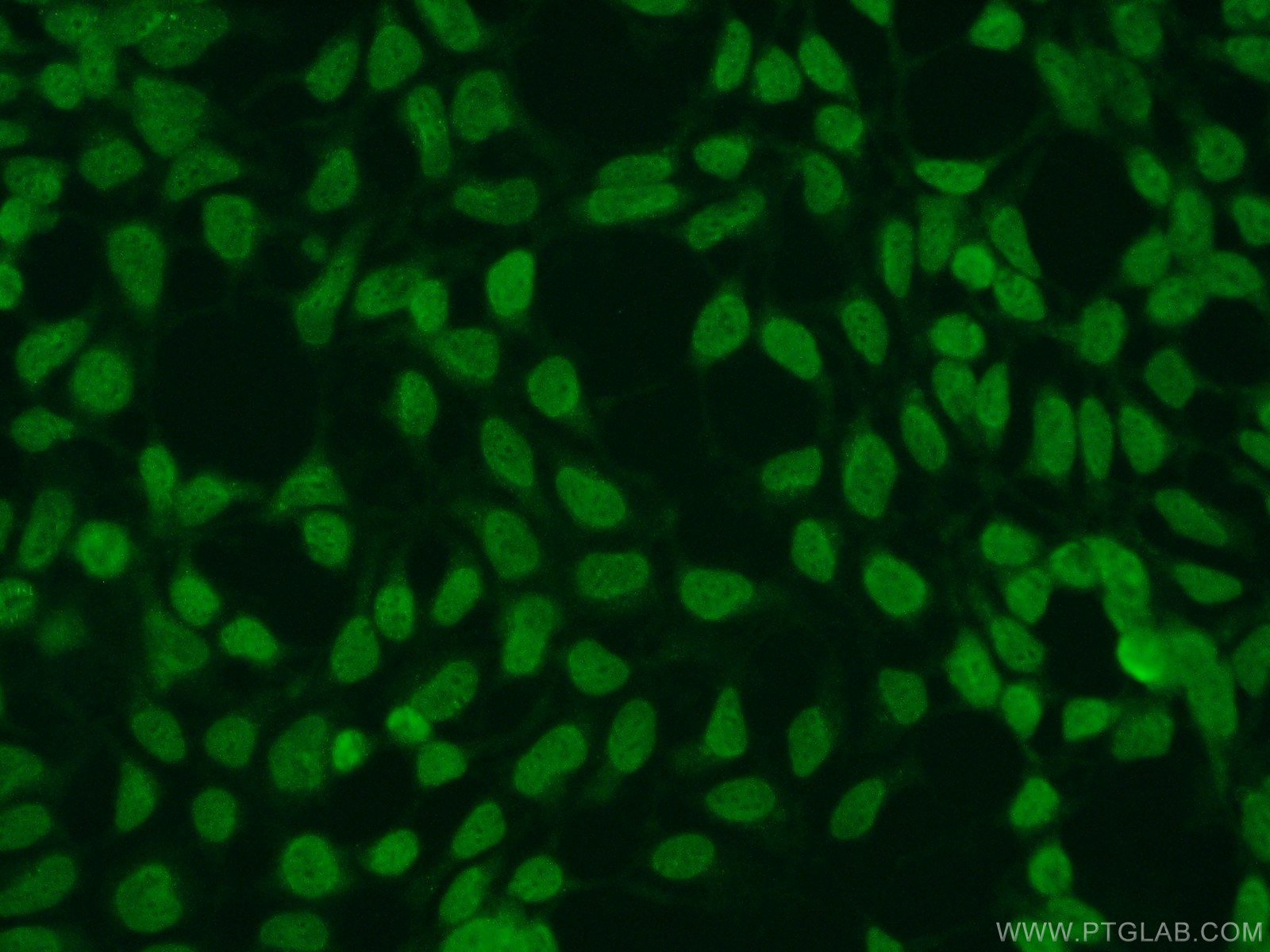 IF Staining of HEK-293 using 10947-1-AP