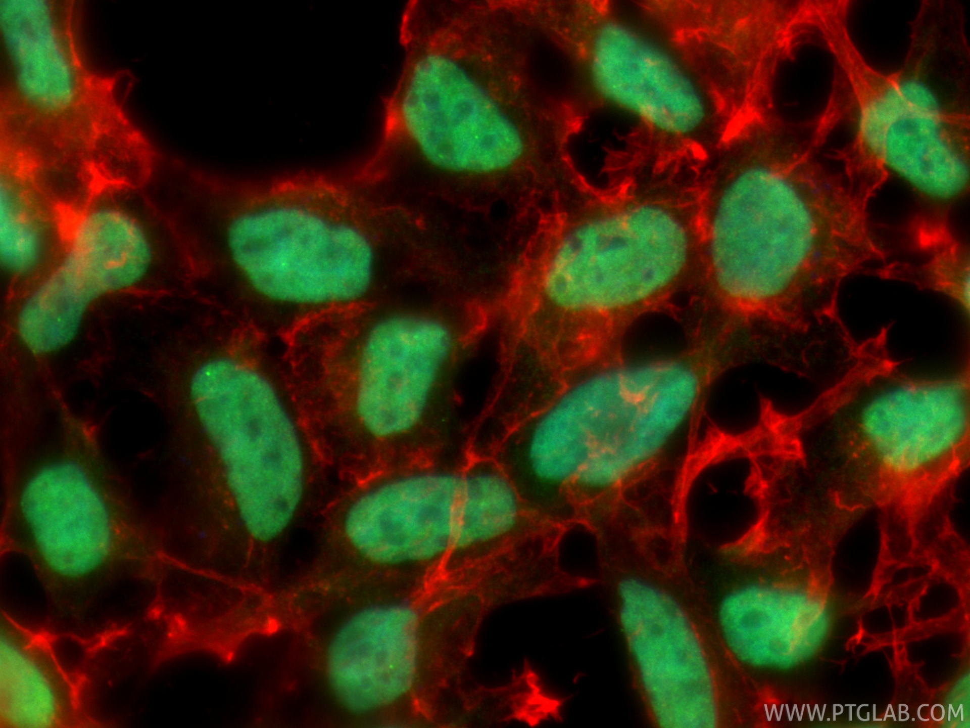 IF Staining of HEK-293 using 11251-1-AP IF Staining of HEK-293 using 11251-1-AP