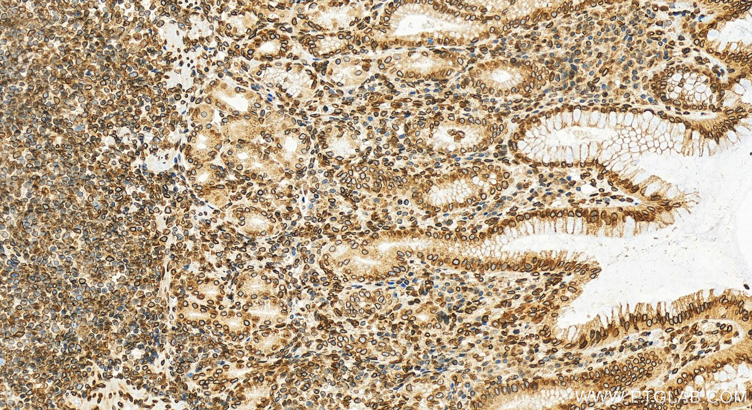 IHC staining of human stomach using 27556-1-AP (same clone as 27556-1-PBS)