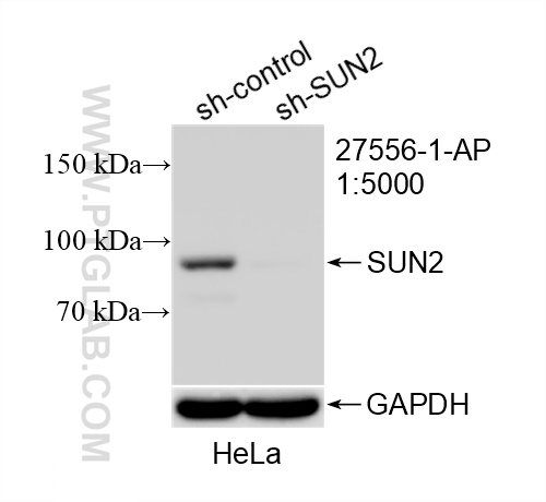 WB analysis of HeLa using 27556-1-AP (same clone as 27556-1-PBS)
