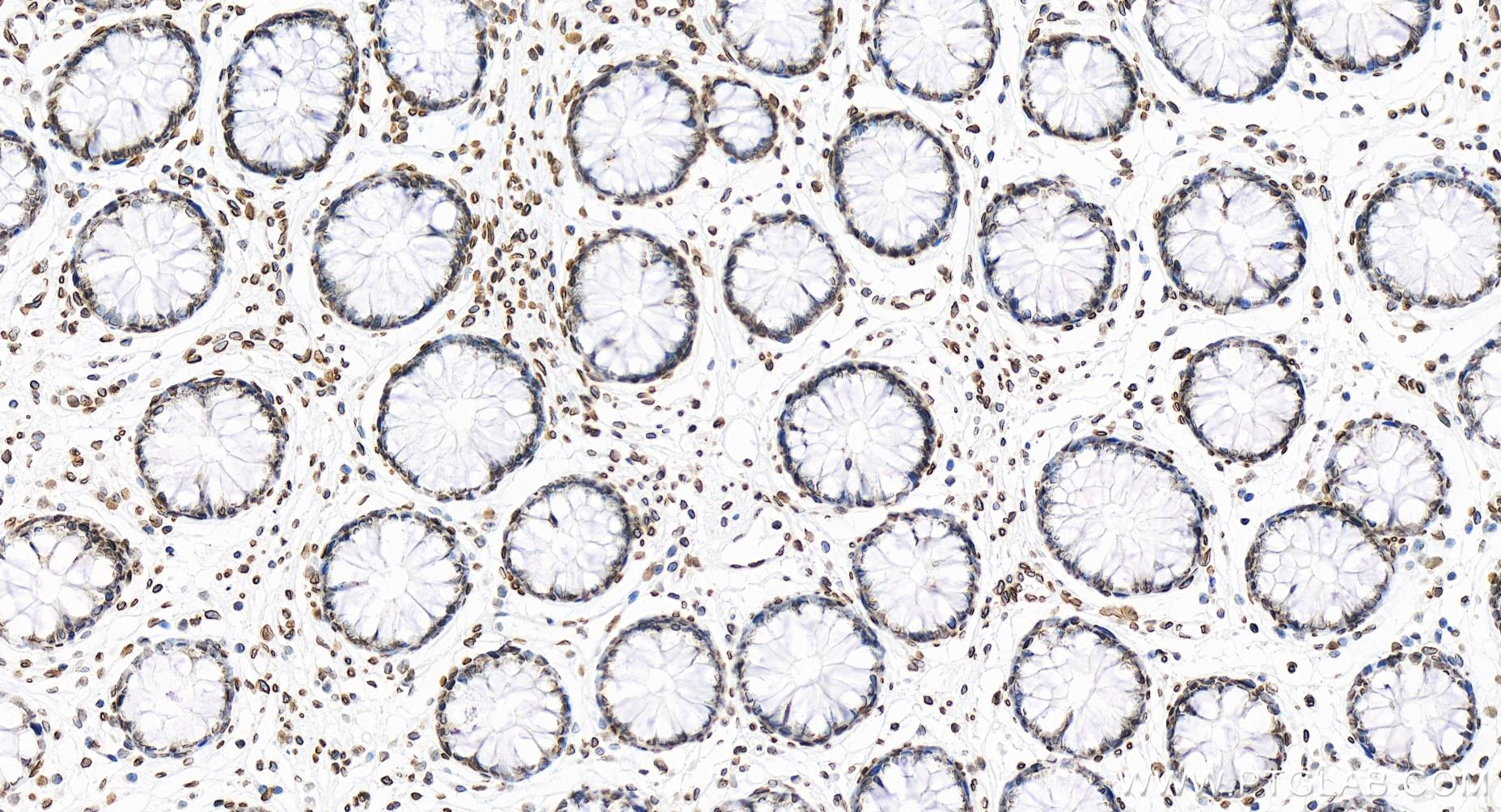IHC staining of human colon using 85103-3-RR (same clone as 85103-3-PBS)