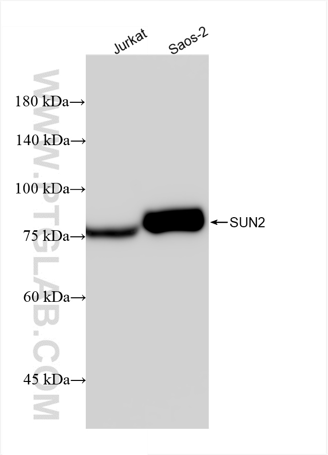 WB analysis using 85103-3-RR (same clone as 85103-3-PBS)
