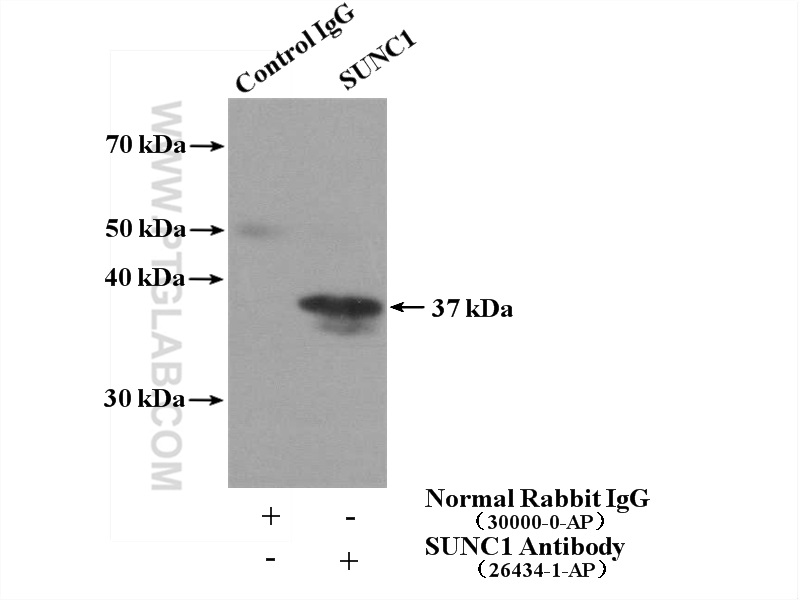 IP experiment of mouse testis using 26434-1-AP