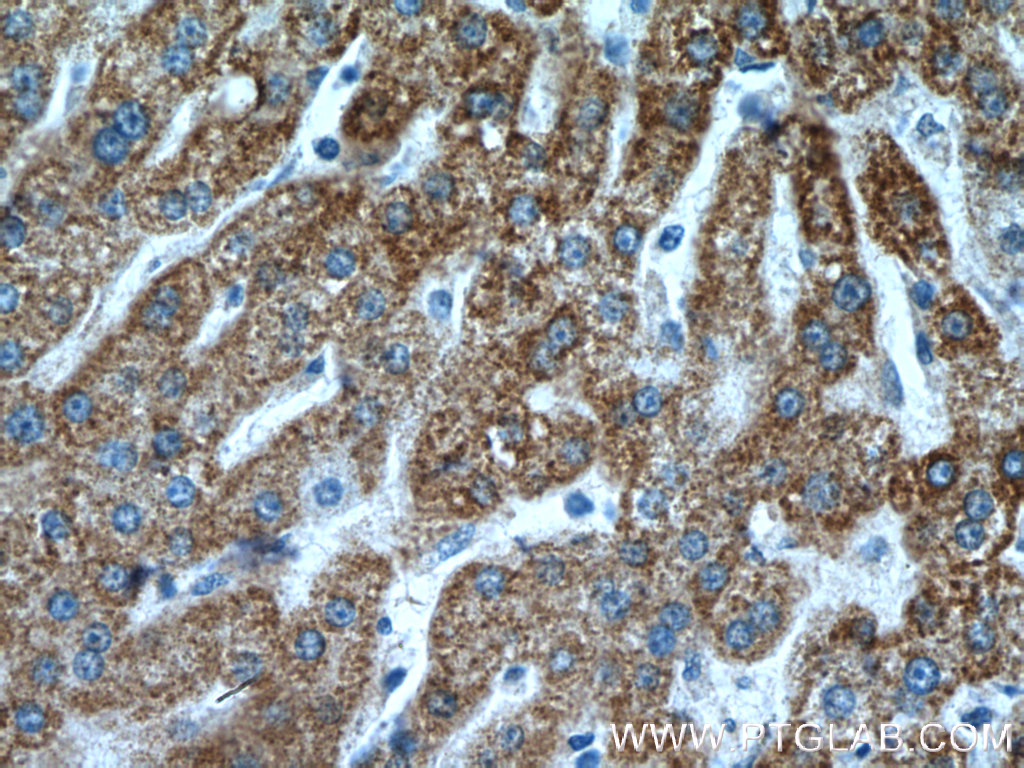 IHC staining of human liver using 15075-1-AP