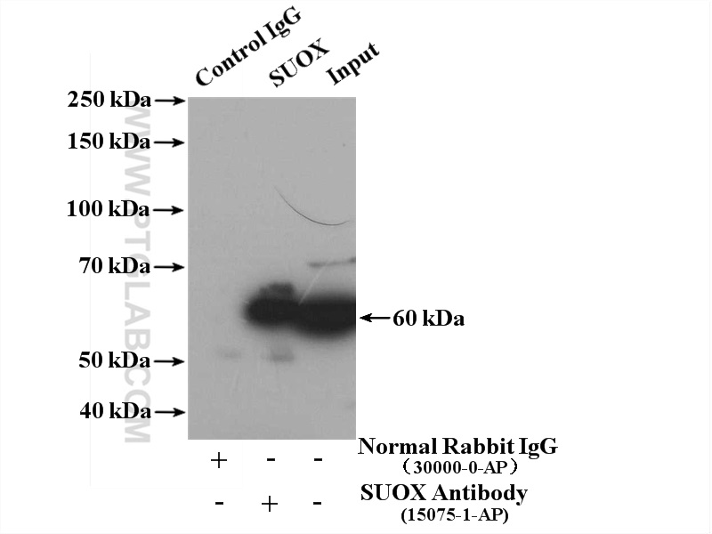 IP experiment of mouse liver using 15075-1-AP