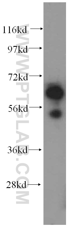 WB analysis of human liver using 15075-1-AP