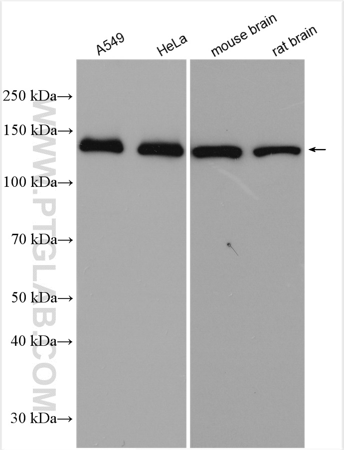 WB analysis using 28598-1-AP